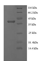 E.coli P protein