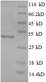 E.coli Superoxide dismutase mitochondrial protein