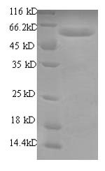 Human RBMY1A1 protein