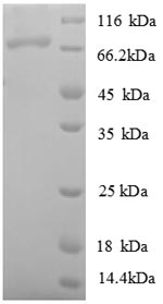 E. coli ligA protein