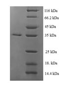 E. coli ssbF protein