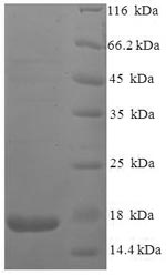 Human vpx protein