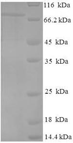 Viral NP protein