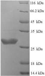 Bovine S protein