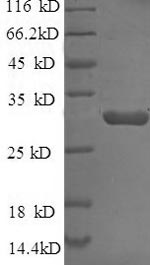 E. coli bla protein