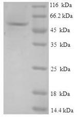 Human GMPR protein