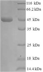 E. coli bla protein