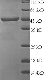 E.coli VP2 protein