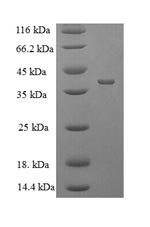 E. coli ompT protein