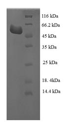 E. coli alaA protein