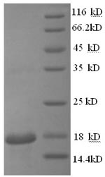 Mouse Hbb-b2 protein