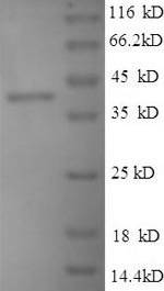 E.coli VP2 protein