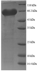 Human gp120 protein