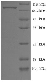 Viral NP protein