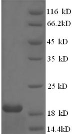 Human E7 protein