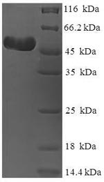 Human VP1 protein