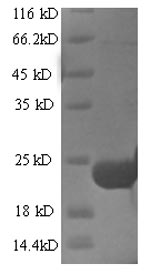 E.coli Trypsin inhibitor DE-3 protein