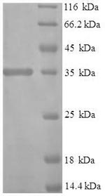 Human IFNA1 protein