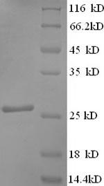 E.coli yoaJ protein