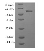 Human CSNK2A2 protein