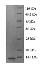 Human LUC7L3 protein