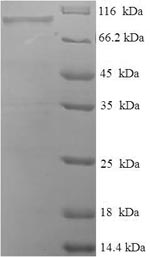 Human EHHADH protein
