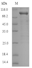 Human PAK1 protein