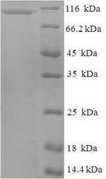 Human GNL2 protein