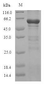 Human NR1H3 protein