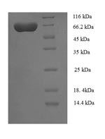 Human UGP2 protein