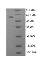 Human RBBP7 protein
