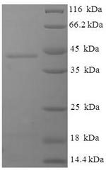 Human DGUOK protein