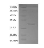 Human COTL1 protein