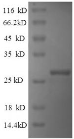 Human IHH protein