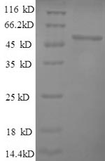 Human HYAL1 protein