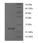 Human PLA2R1 protein