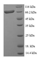 Human ARHGAP19 protein