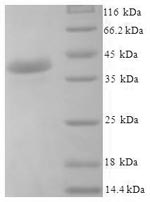 Human JOSD1 protein