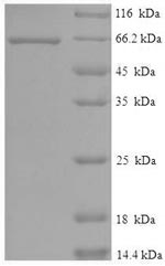 Human STK11 protein