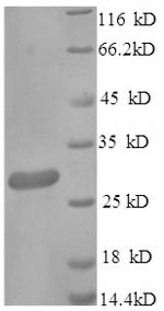 Mouse Cd163 protein