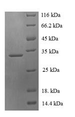 Human PDZD11 protein