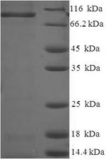 Rat Caprin1 protein
