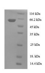 Human TBCEL protein