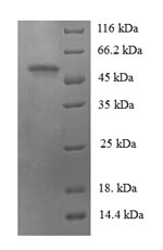 Human PDZK1 protein