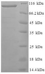 Human FAM160B1 protein