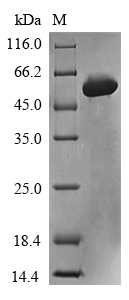Human METRNL protein