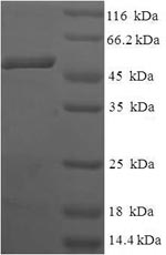Human CIAPIN1 protein