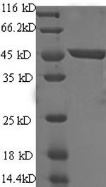 Human ILDR2 protein