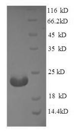 Human C19orf80 protein
