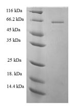 Human PLCZ1 protein